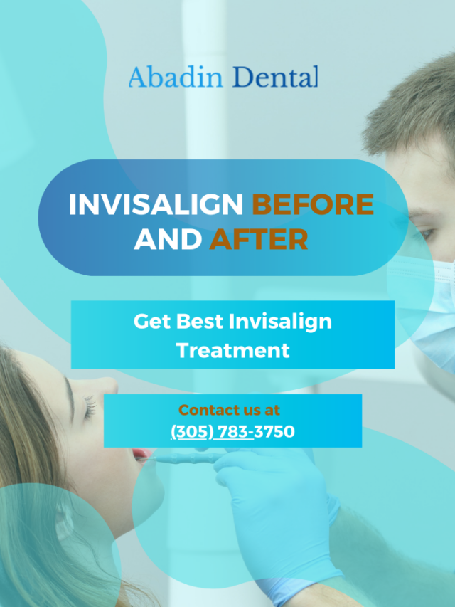 Invisalign Before And After | Abadin Dental